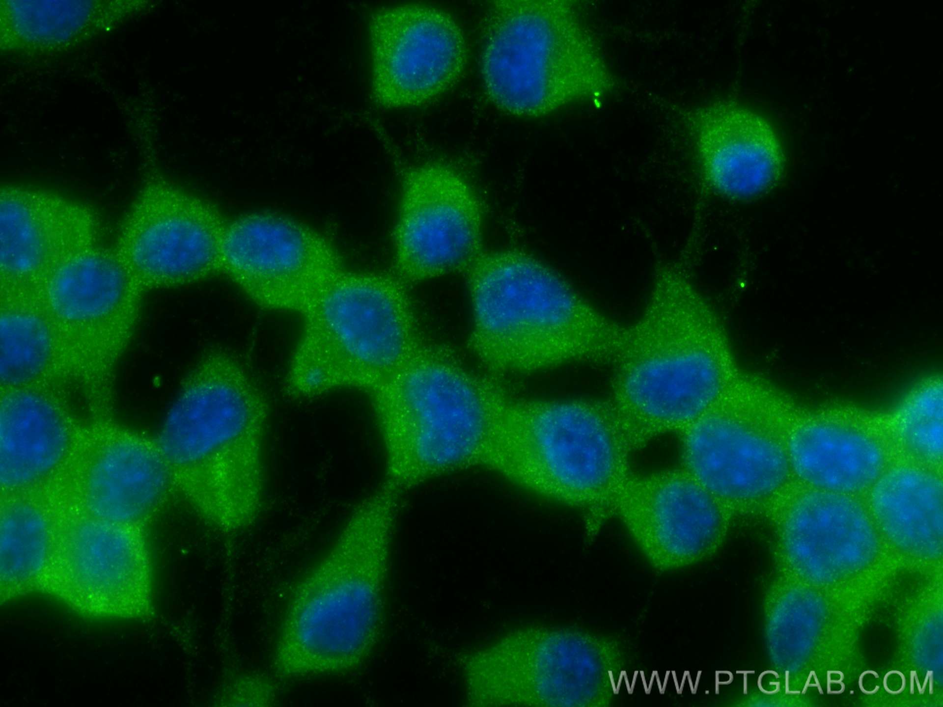 Immunofluorescence (IF) / fluorescent staining of Neuro-2a cells using Chromogranin A Polyclonal antibody (23342-1-AP)