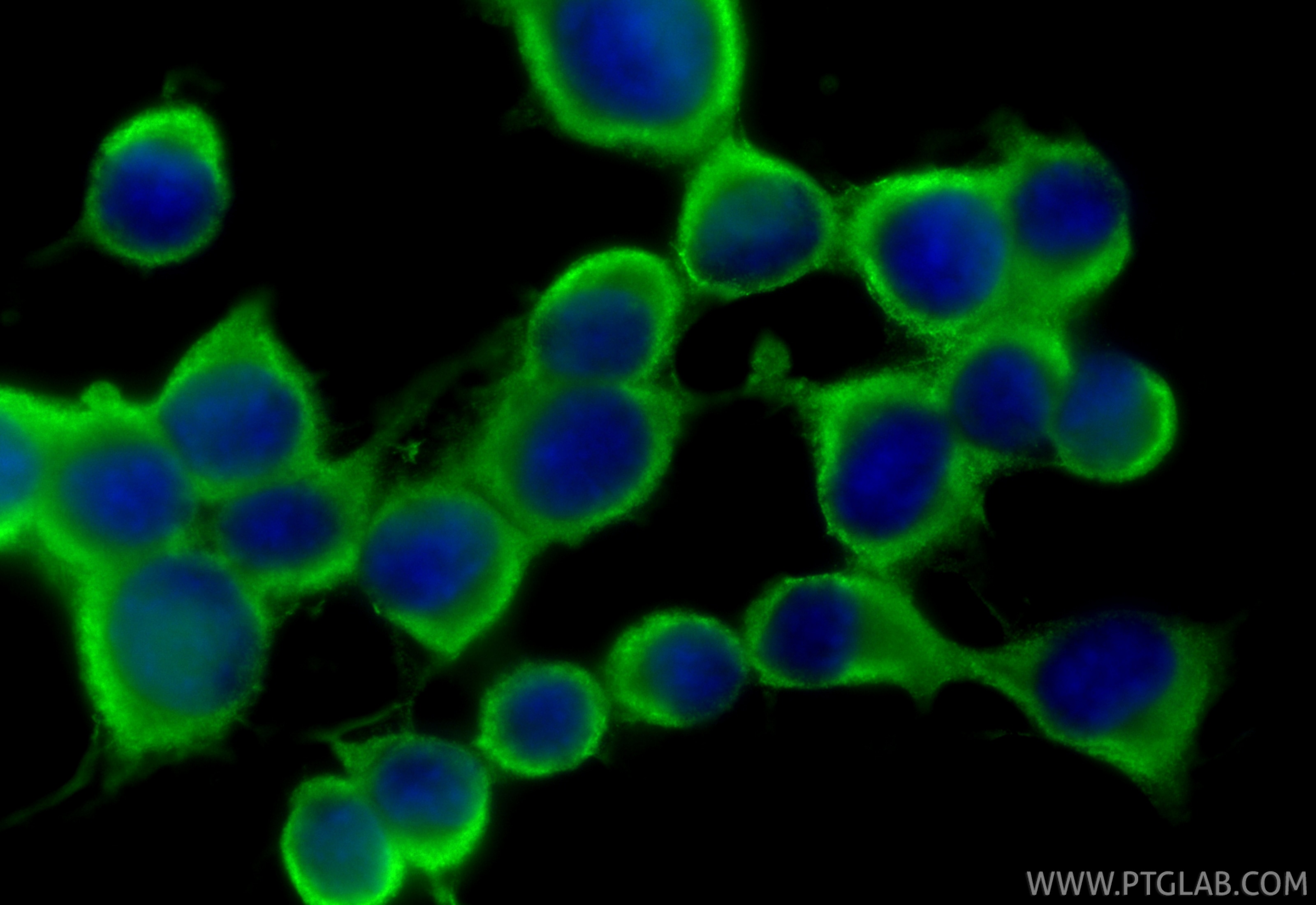 Immunofluorescence (IF) / fluorescent staining of Neuro-2a cells using Chromogranin A Polyclonal antibody (23342-1-AP)