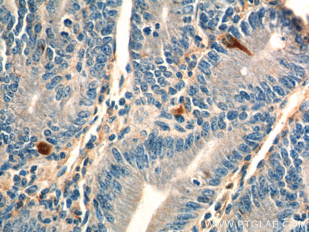 Immunohistochemistry (IHC) staining of mouse colon tissue using Chromogranin A Polyclonal antibody (23342-1-AP)