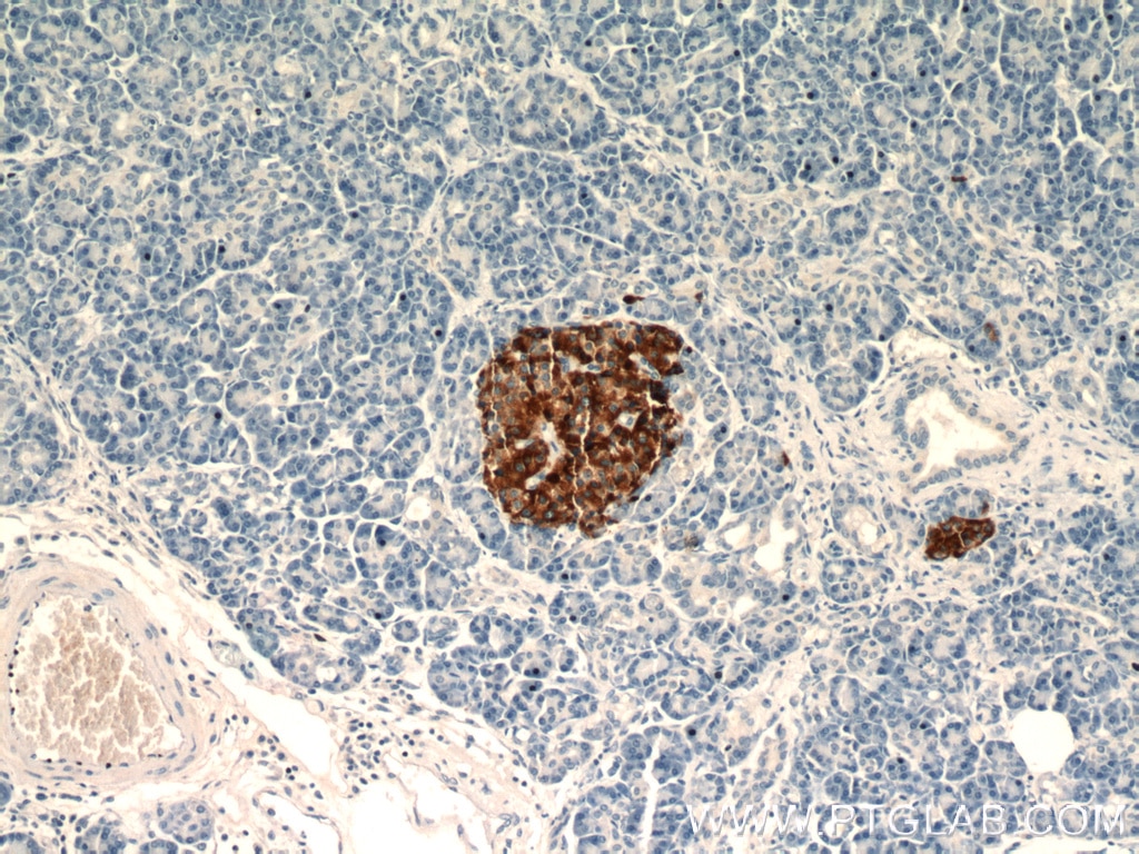 IHC staining of human pancreas using 23342-1-AP