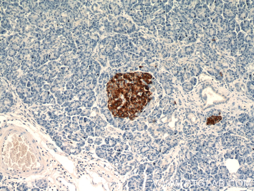 Immunohistochemistry (IHC) staining of human pancreas tissue using Chromogranin A Polyclonal antibody (23342-1-AP)