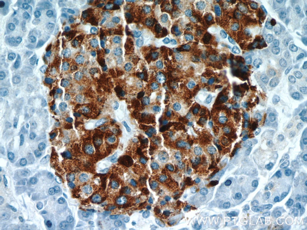 Immunohistochemistry (IHC) staining of human pancreas tissue using Chromogranin A Polyclonal antibody (23342-1-AP)