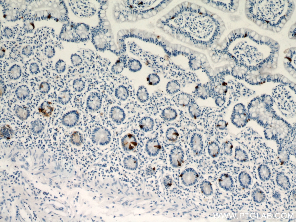 Immunohistochemistry (IHC) staining of human small intestine tissue using Chromogranin A Polyclonal antibody (23342-1-AP)