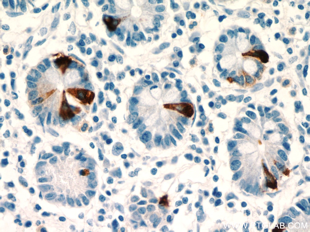 Immunohistochemistry (IHC) staining of human small intestine tissue using Chromogranin A Polyclonal antibody (23342-1-AP)