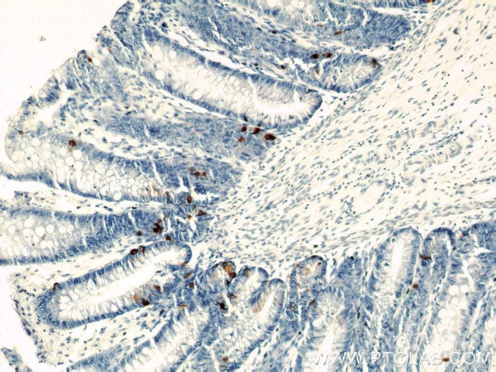 Immunohistochemistry (IHC) staining of human colon tissue using Chromogranin A Polyclonal antibody (23342-1-AP)