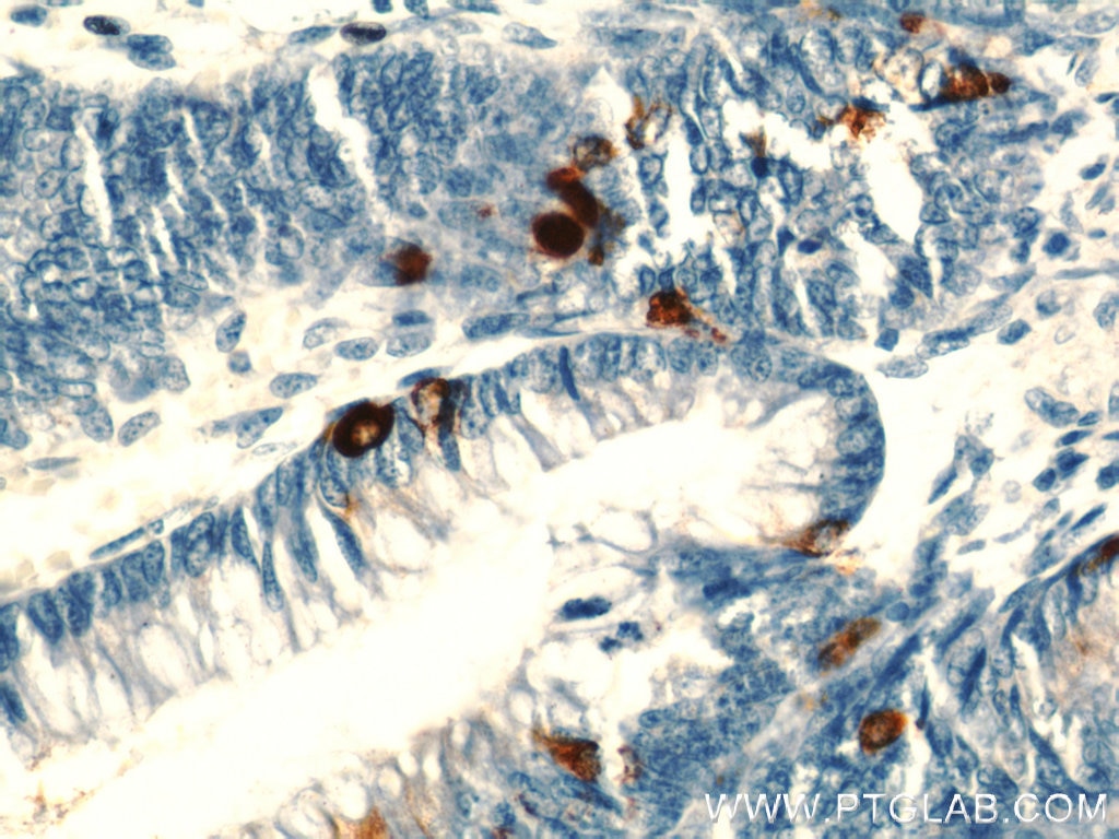 Immunohistochemistry (IHC) staining of human colon tissue using Chromogranin A Polyclonal antibody (23342-1-AP)