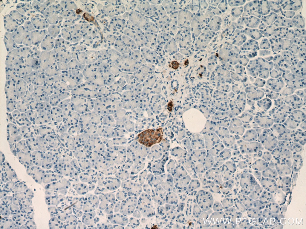 Immunohistochemistry (IHC) staining of human pancreas tissue using Chromogranin A Monoclonal antibody (60135-1-Ig)