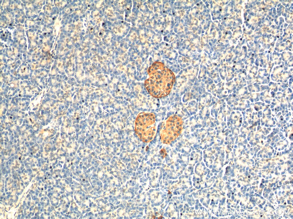 Chromogranin A Monoclonal antibody