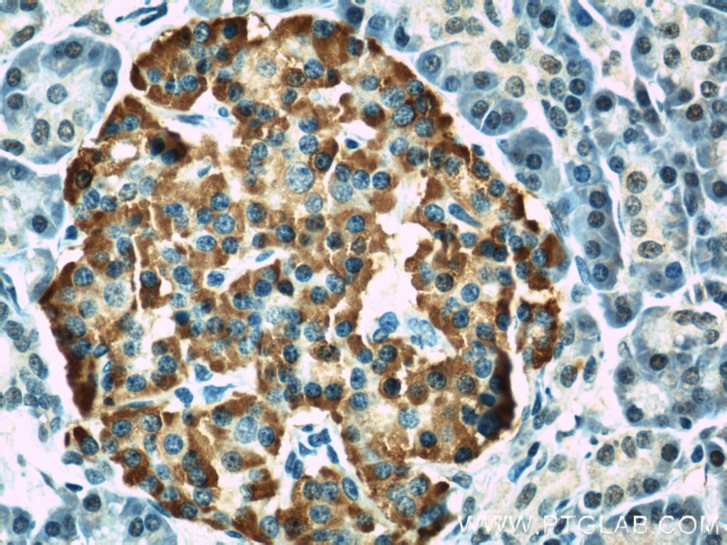 Chromogranin A Monoclonal antibody