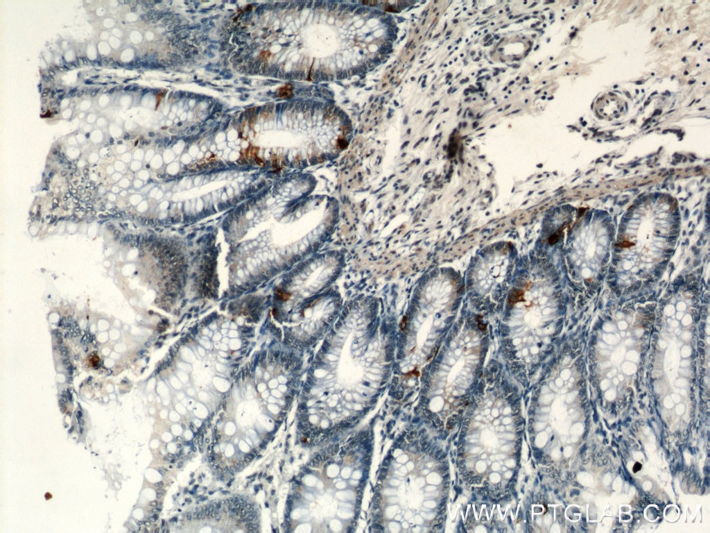 Immunohistochemistry (IHC) staining of human colon tissue using Chromogranin A Monoclonal antibody (60135-1-Ig)