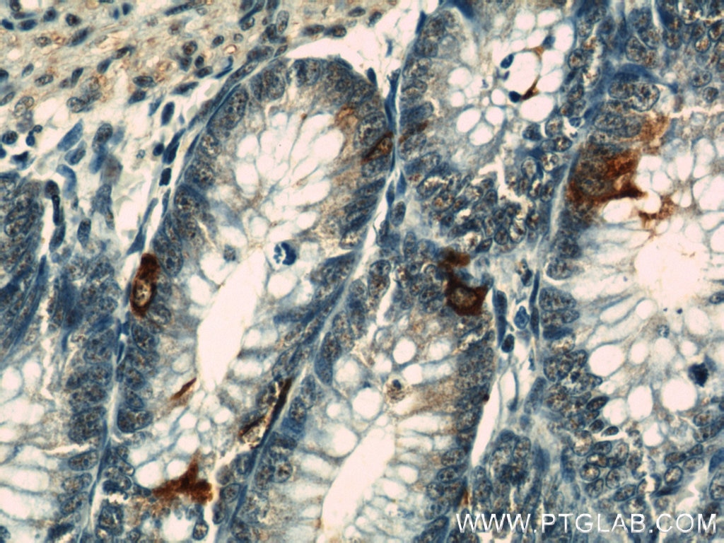 Immunohistochemistry (IHC) staining of human colon tissue using Chromogranin A Monoclonal antibody (60135-1-Ig)