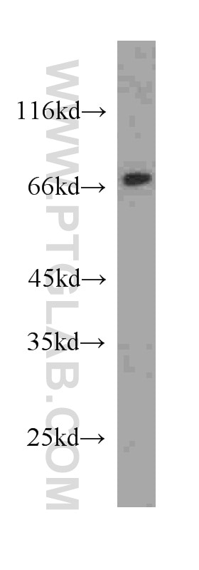 Chromogranin A Monoclonal antibody