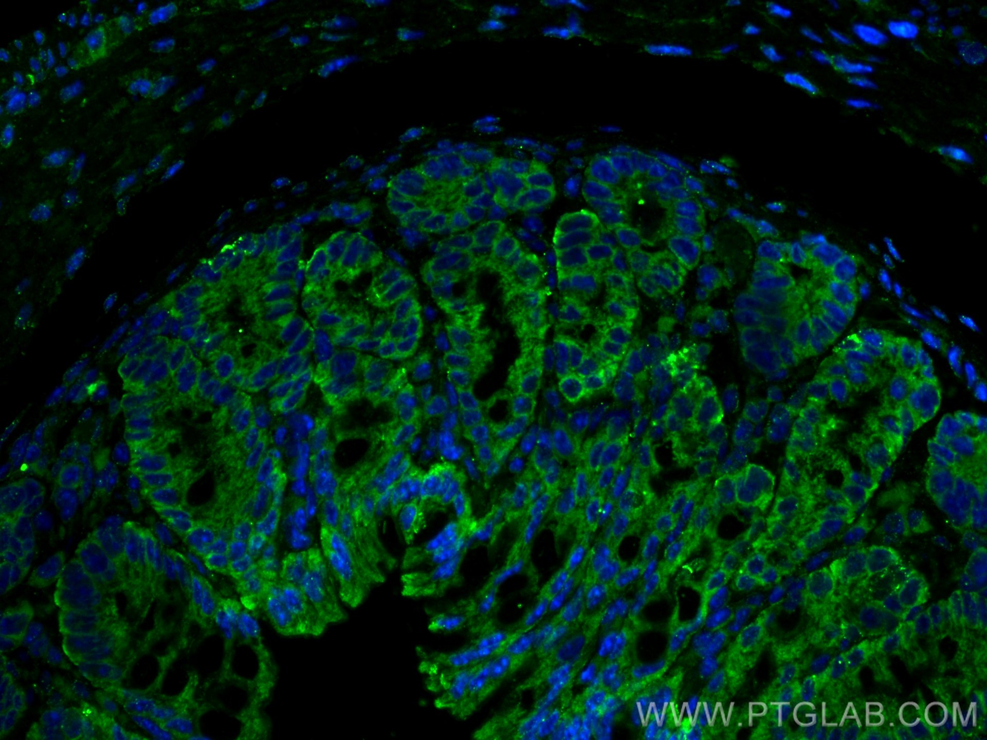 IF Staining of mouse colon using 14968-1-AP