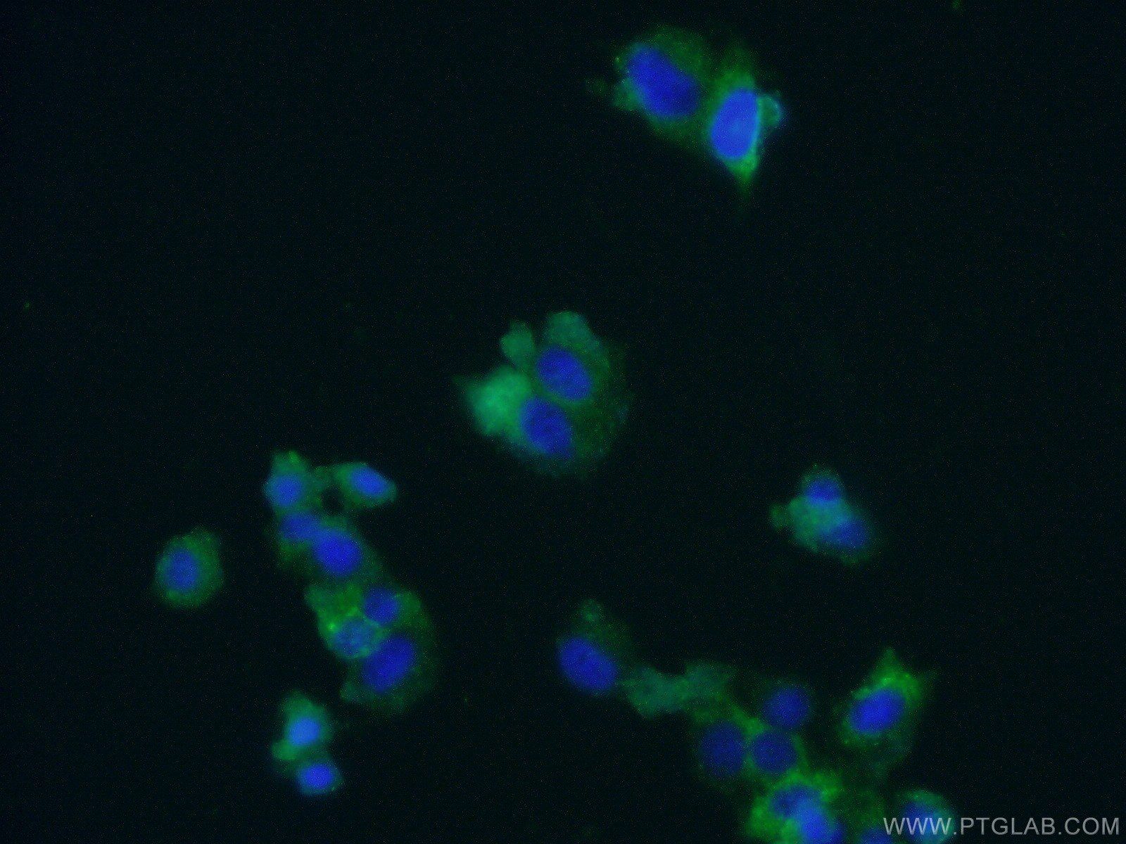 Chromogranin B