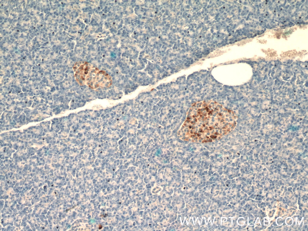 Immunohistochemistry (IHC) staining of human pancreas tissue using Chromogranin B Polyclonal antibody (14968-1-AP)