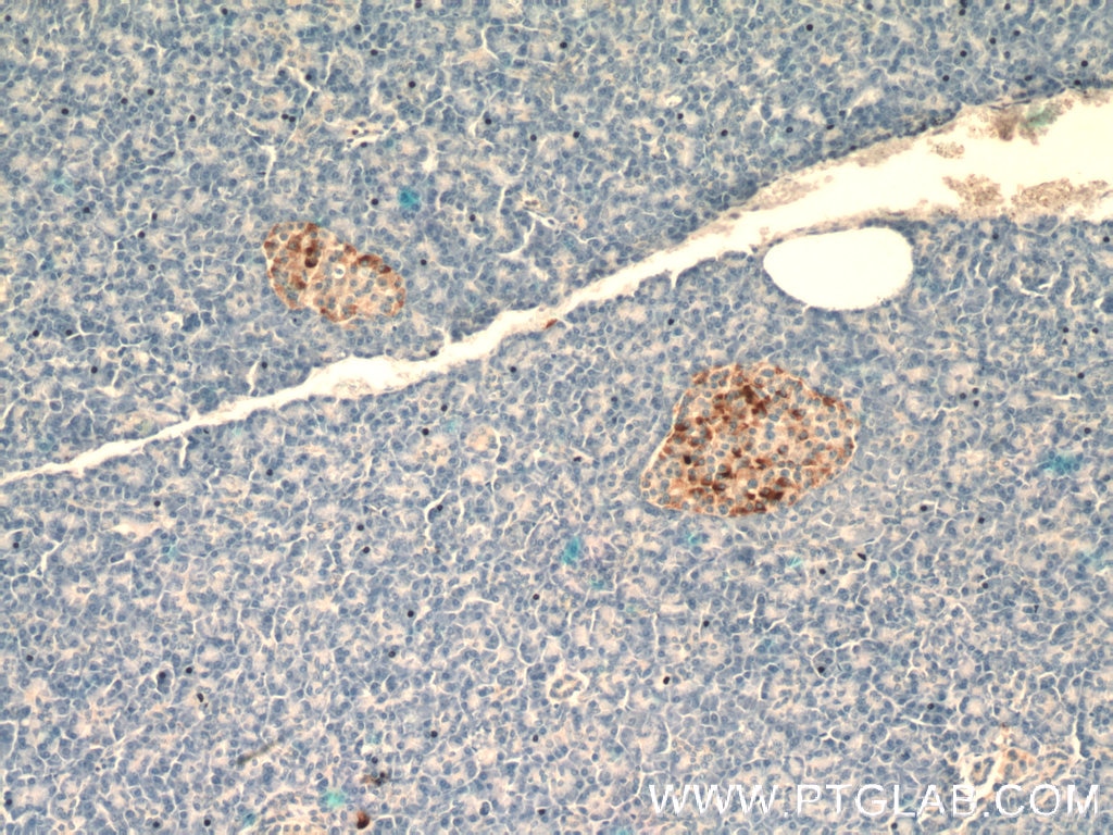 IHC staining of human pancreas using 14968-1-AP