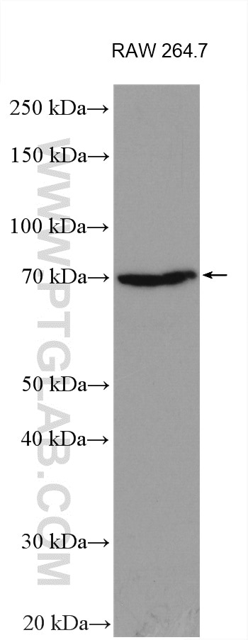 Western Blot (WB) analysis of various lysates using Chromogranin B Polyclonal antibody (14968-1-AP)