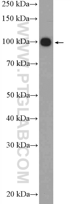 WB analysis of PC-12 using 14968-1-AP