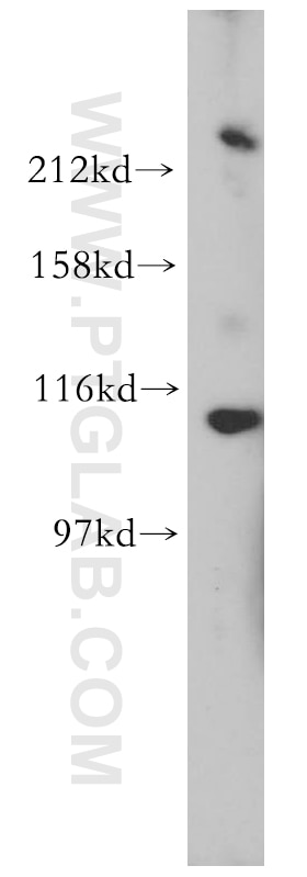 Western Blot (WB) analysis of mouse brain tissue using Chromogranin B Polyclonal antibody (14968-1-AP)
