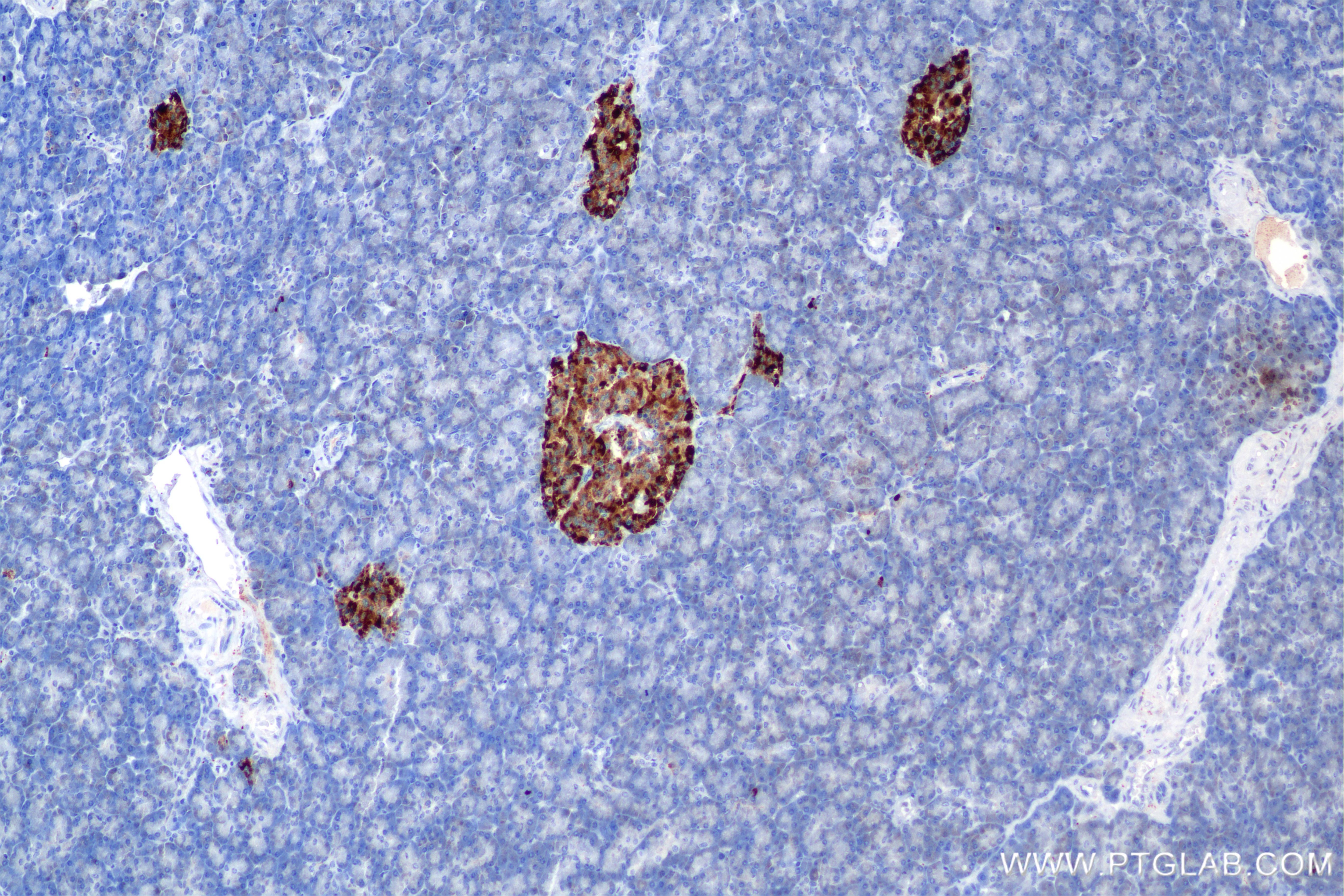 Immunohistochemical analysis of paraffin-embedded human pancreas tissue slide using 85438-4-RR (CHGB antibody) at dilution of 1:1000 (under 10x lens). Heat mediated antigen retrieval with Tris-EDTA buffer (pH 9.0). Immunohistochemistry (IHC) staining of human pancreas tissue using CHGB Recombinant monoclonal antibody (85438-4-RR)
