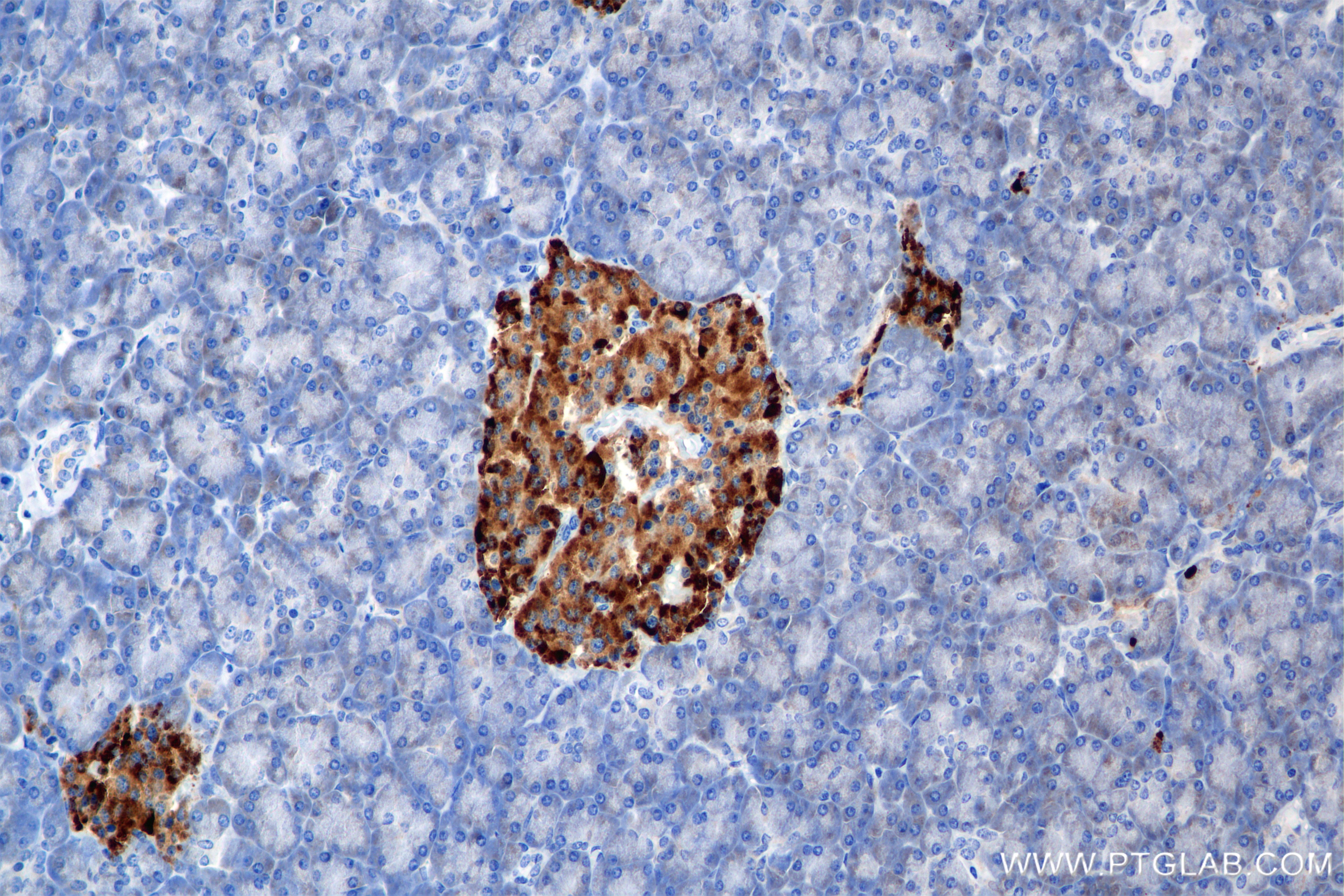 Immunohistochemical analysis of paraffin-embedded human pancreas tissue slide using 85438-4-RR (CHGB antibody) at dilution of 1:1000 (under 20x lens). Heat mediated antigen retrieval with Tris-EDTA buffer (pH 9.0). Immunohistochemistry (IHC) staining of human pancreas tissue using CHGB Recombinant monoclonal antibody (85438-4-RR)
