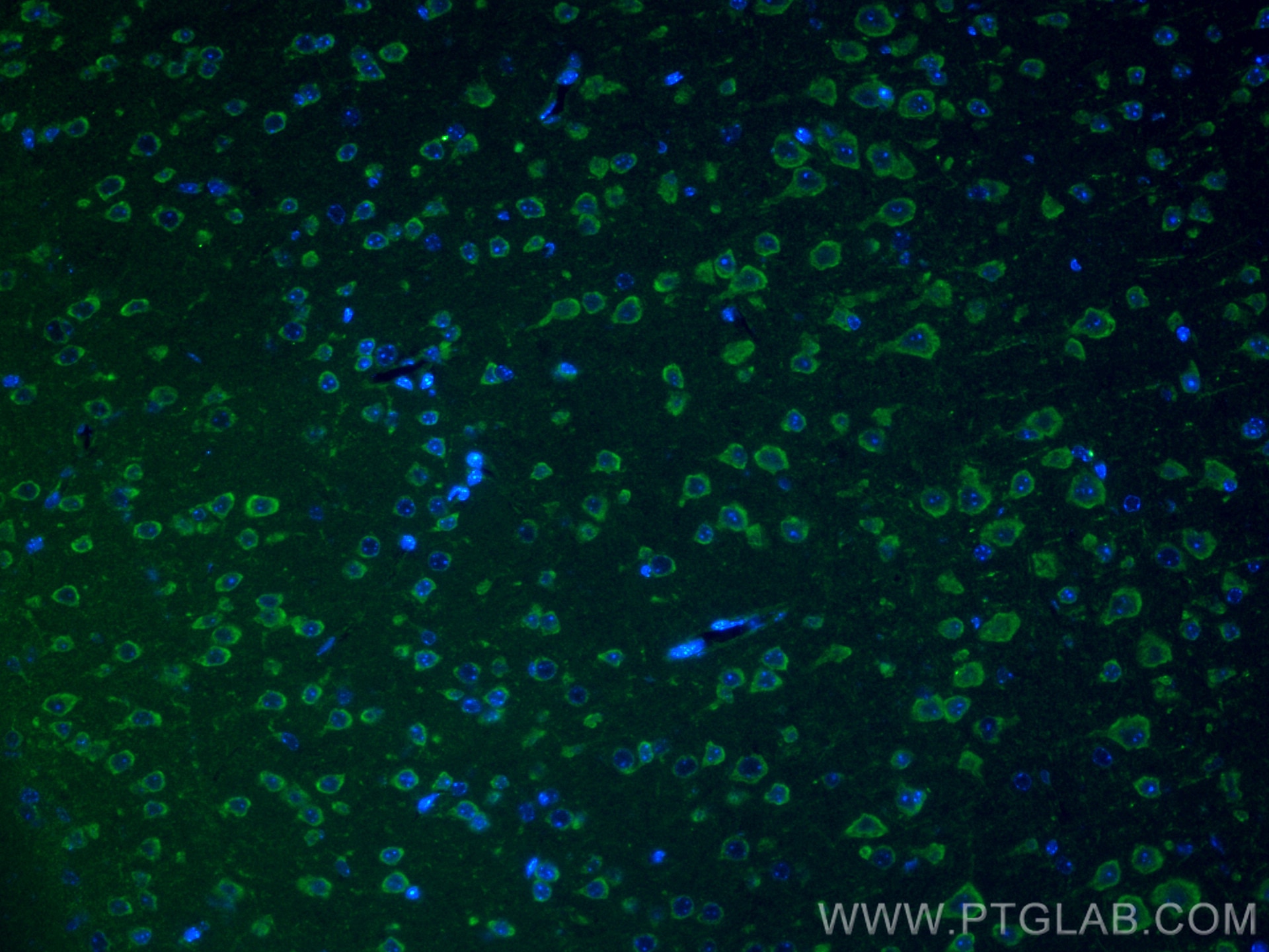 Immunofluorescence (IF) / fluorescent staining of mouse brain tissue using CHI3L1/YKL40 Polyclonal antibody (12036-1-AP)