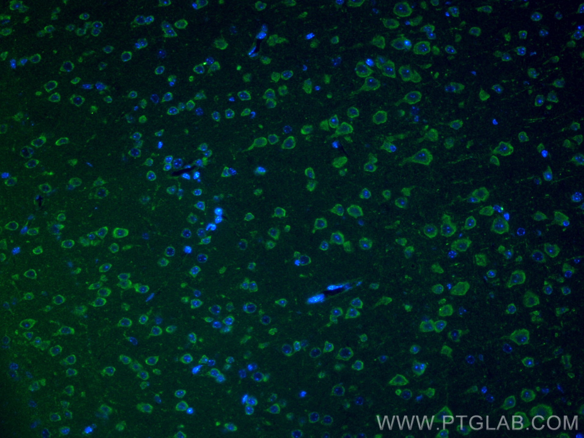 Immunofluorescence (IF) / fluorescent staining of mouse brain tissue using CHI3L1 / YKL-40 Polyclonal antibody (12036-1-AP)
