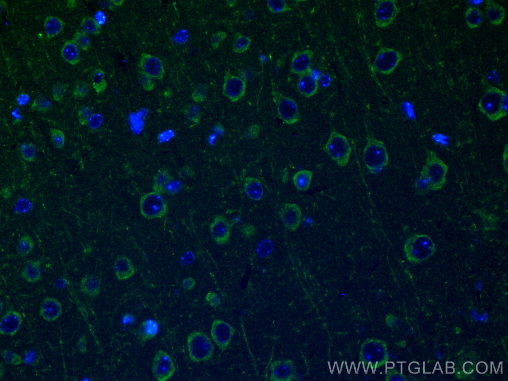 Immunofluorescence (IF) / fluorescent staining of mouse brain tissue using CHI3L1/YKL40 Polyclonal antibody (12036-1-AP)