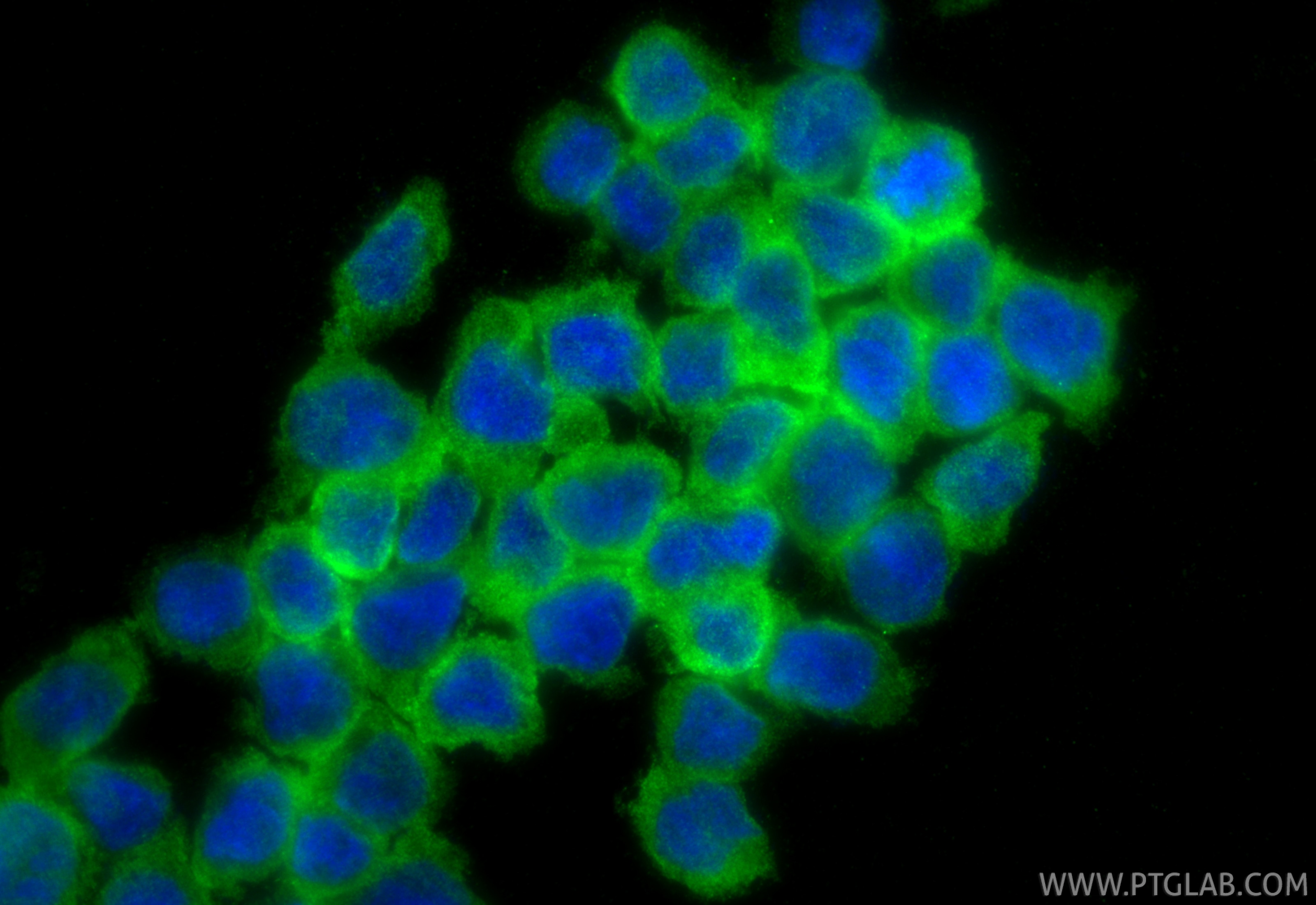 Immunofluorescent analysis of (4% PFA) fixed THP-1 cells using CHI3L1/YKL40 antibody (12036-1-AP) at dilution of 1:400 and CoraLite®488-Conjugated Goat Anti-Rabbit IgG(H+L) (SA00013-2). Immunofluorescence (IF) / fluorescent staining of THP-1 cells using CHI3L1/YKL40 Polyclonal antibody (12036-1-AP)