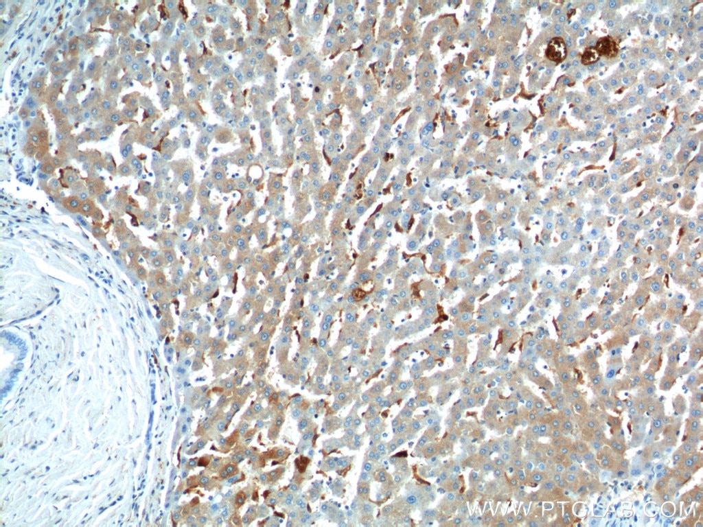 Immunohistochemistry (IHC) staining of human liver tissue using CHI3L1/YKL40 Polyclonal antibody (12036-1-AP)