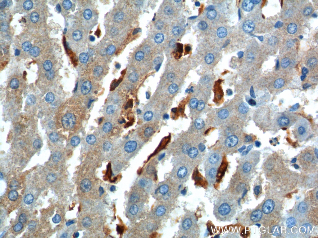 Immunohistochemistry (IHC) staining of human liver tissue using CHI3L1/YKL40 Polyclonal antibody (12036-1-AP)