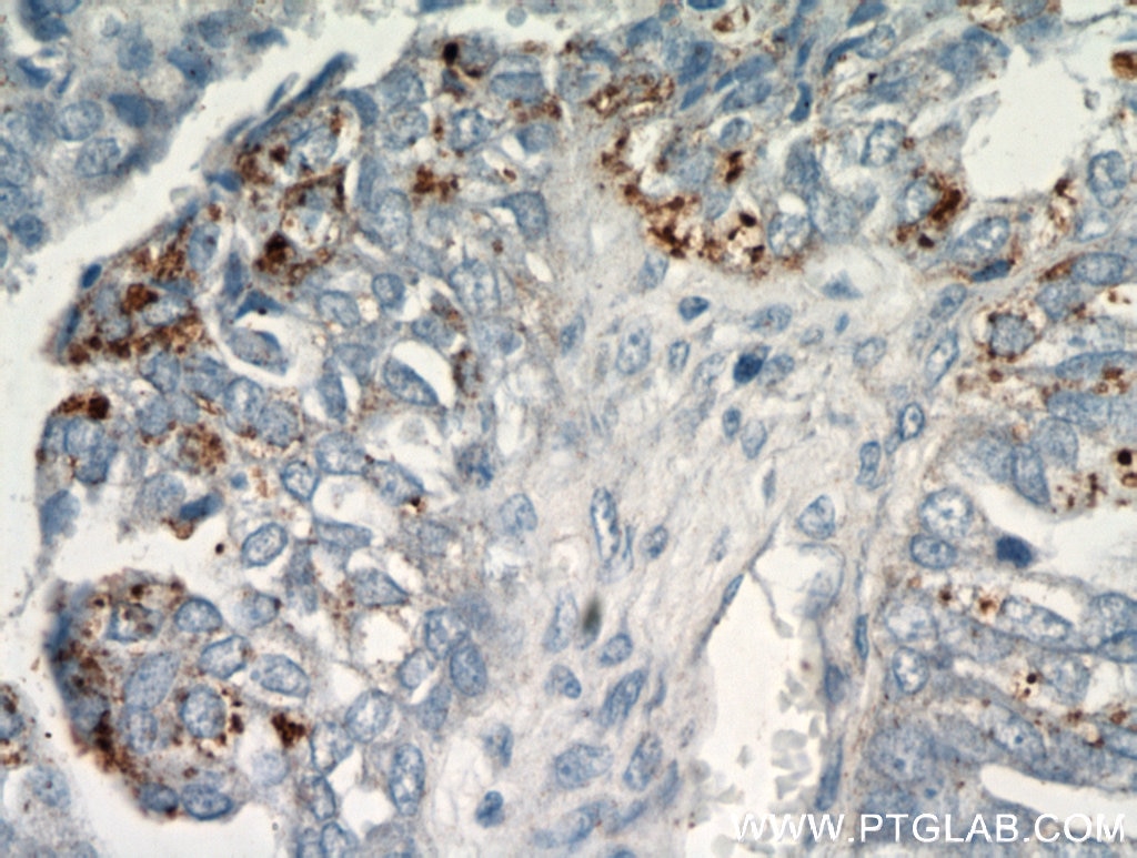 CHI3L1/YKL40 Polyclonal antibody