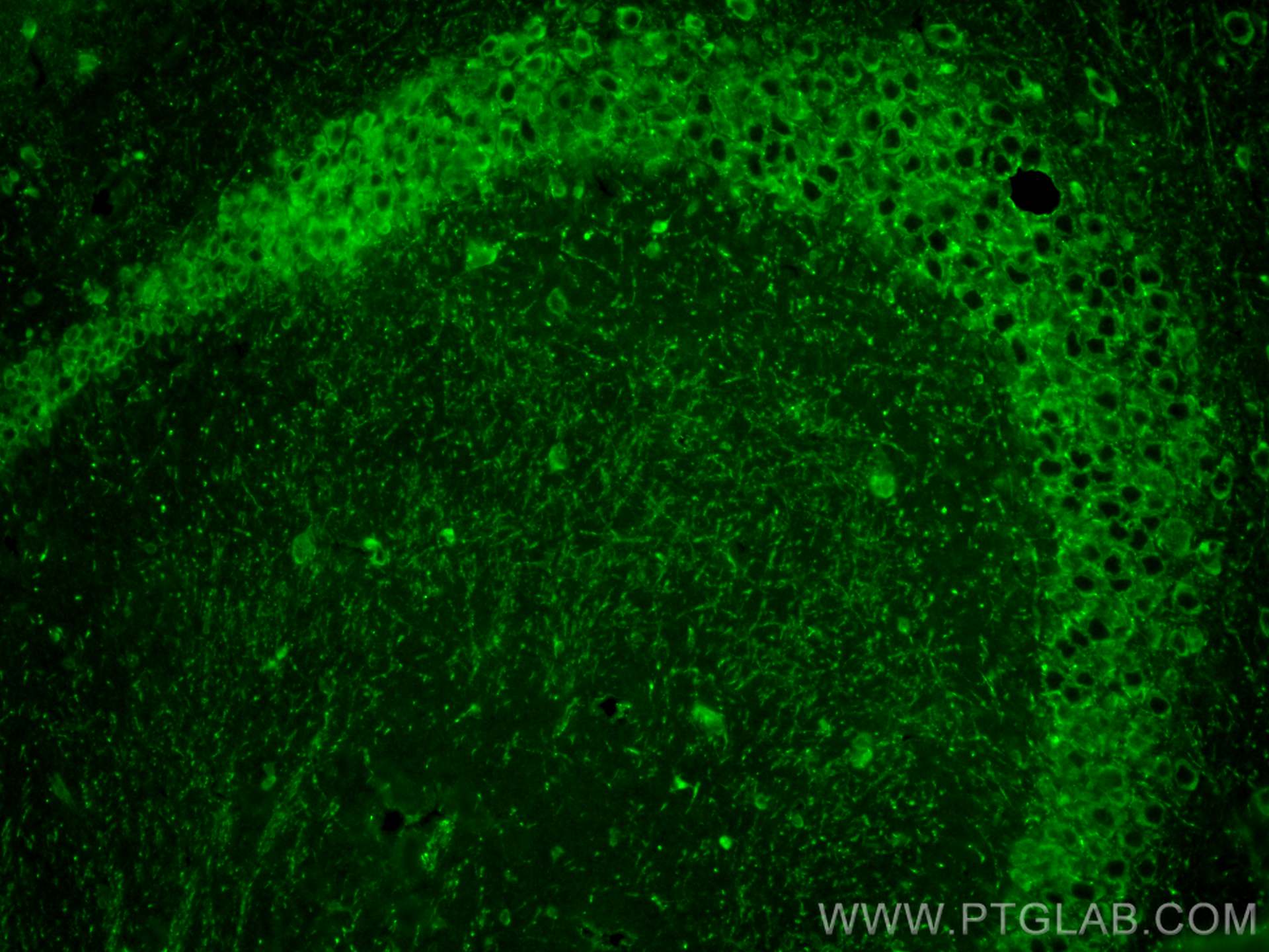 Immunofluorescence (IF) / fluorescent staining of mouse brain tissue using CHI3L1 Polyclonal antibody (30419-1-AP)