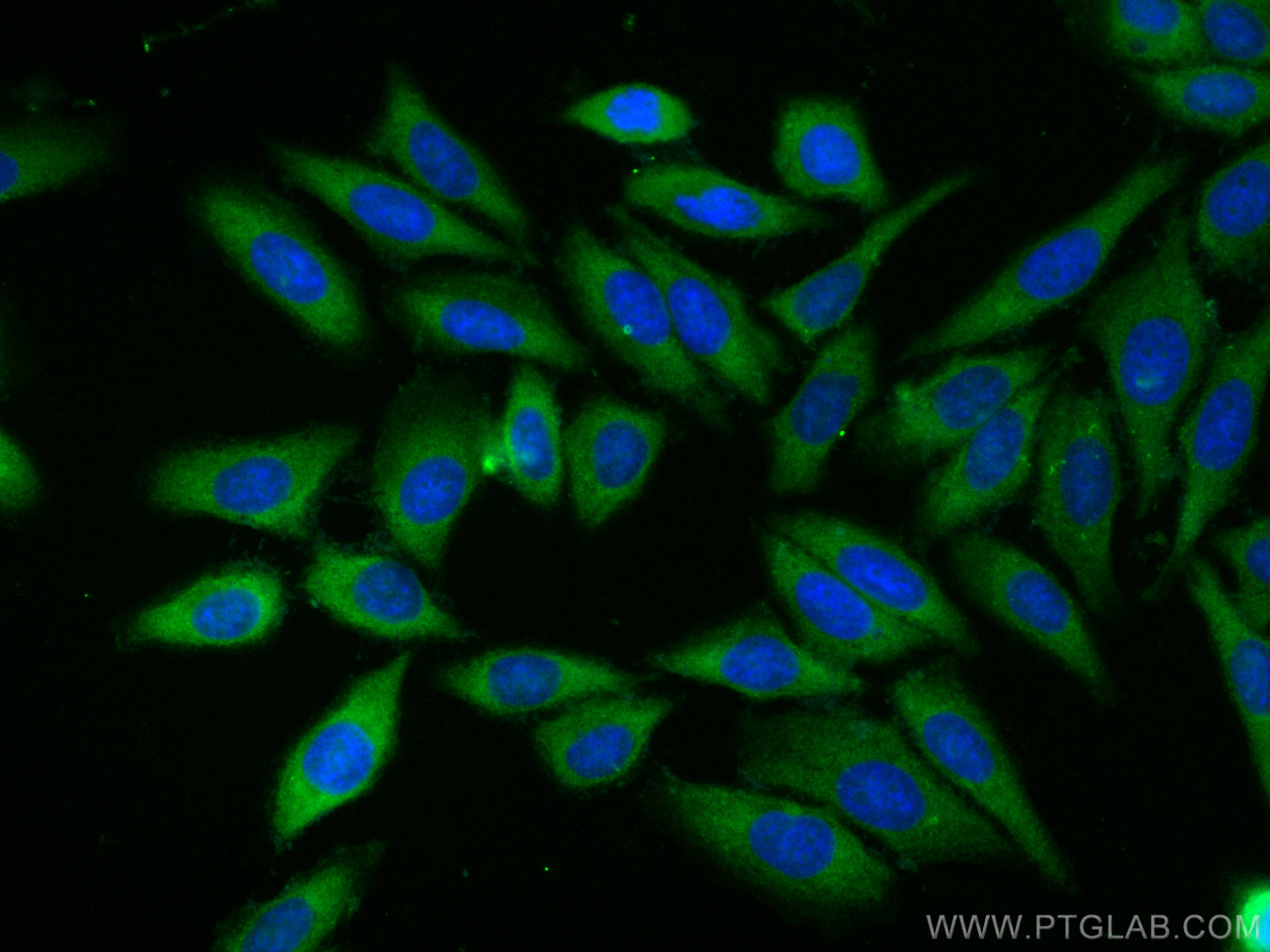 Immunofluorescence (IF) / fluorescent staining of HepG2 cells using CoraLite® Plus 488-conjugated CHI3L1/YKL40 Polyclo (CL488-12036)