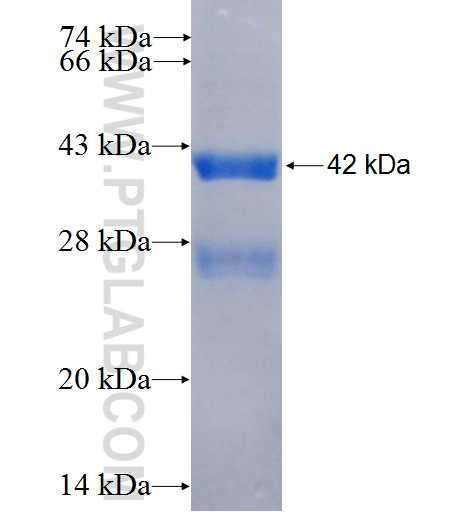 CHI3L2 fusion protein Ag26386 SDS-PAGE