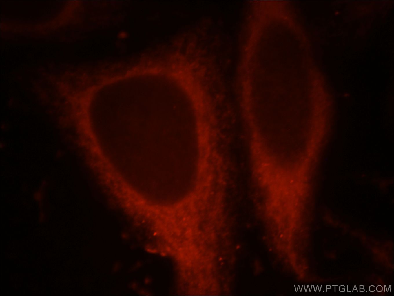 Immunofluorescence (IF) / fluorescent staining of HepG2 cells using CHIA Polyclonal antibody (21484-1-AP)