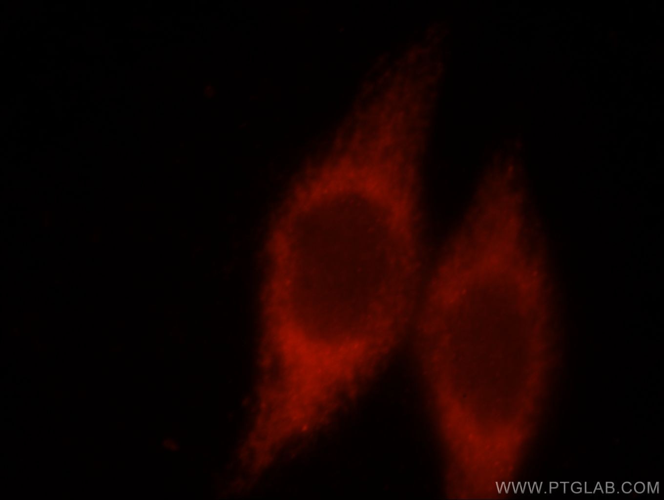 Immunofluorescence (IF) / fluorescent staining of HeLa cells using CHIA Polyclonal antibody (21484-1-AP)