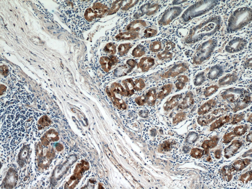 Immunohistochemistry (IHC) staining of human stomach tissue using CHIA Polyclonal antibody (21484-1-AP)