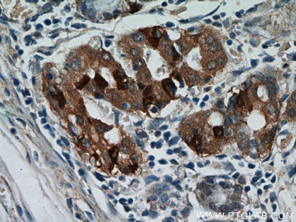 Immunohistochemistry (IHC) staining of human stomach tissue using CHIA Polyclonal antibody (21484-1-AP)