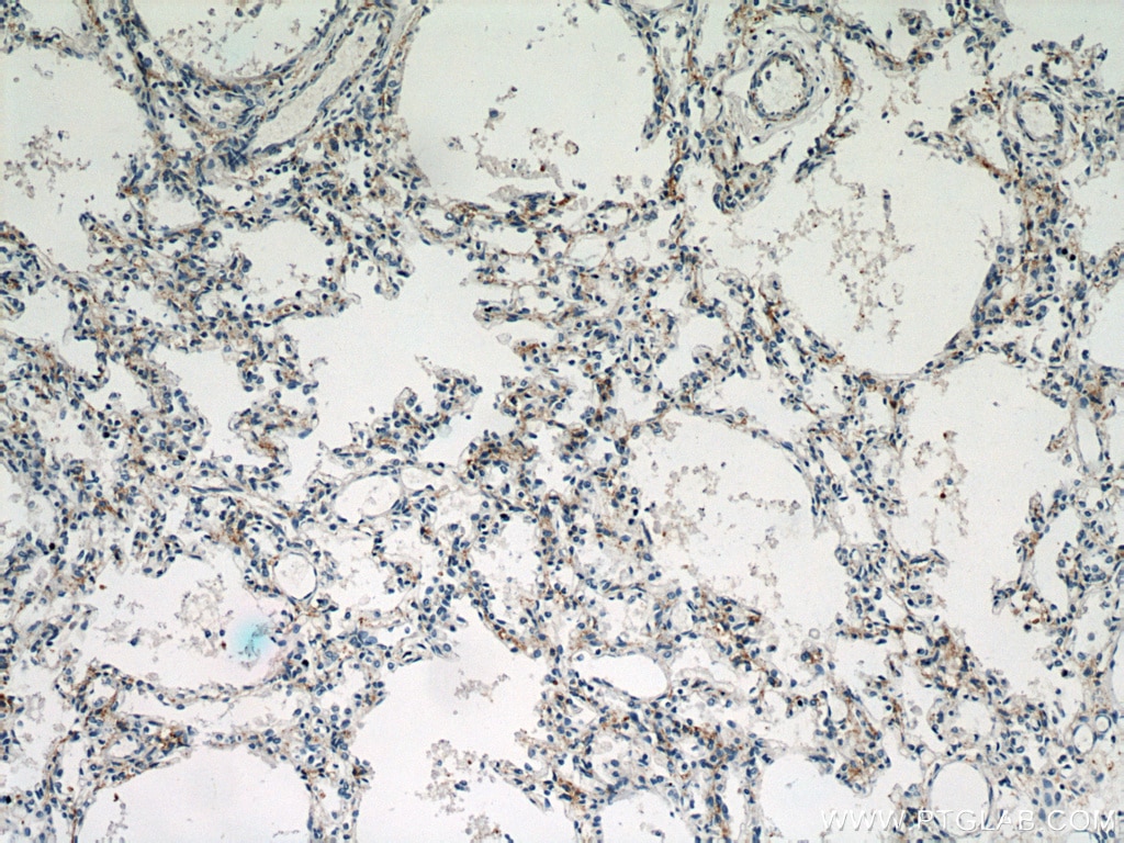 Immunohistochemistry (IHC) staining of human lung tissue using CHIA Polyclonal antibody (21484-1-AP)