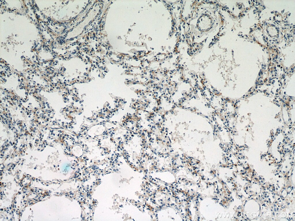 Immunohistochemistry (IHC) staining of human lung tissue using CHIA Polyclonal antibody (21484-1-AP)