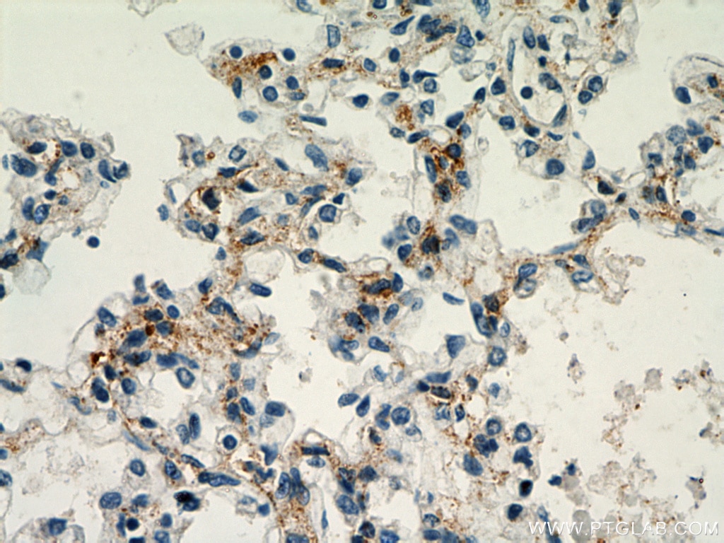 Immunohistochemistry (IHC) staining of human lung tissue using CHIA Polyclonal antibody (21484-1-AP)