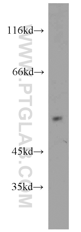 Western Blot (WB) analysis of mouse lung tissue using CHIA Polyclonal antibody (21484-1-AP)