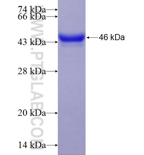 CHIA fusion protein Ag15767 SDS-PAGE