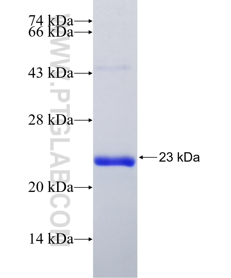 CHIC2 fusion protein Ag28719 SDS-PAGE