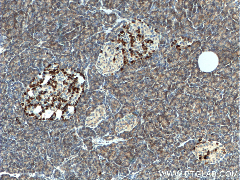 Immunohistochemistry (IHC) staining of human pancreas tissue using CHIT1 Polyclonal antibody (21432-1-AP)