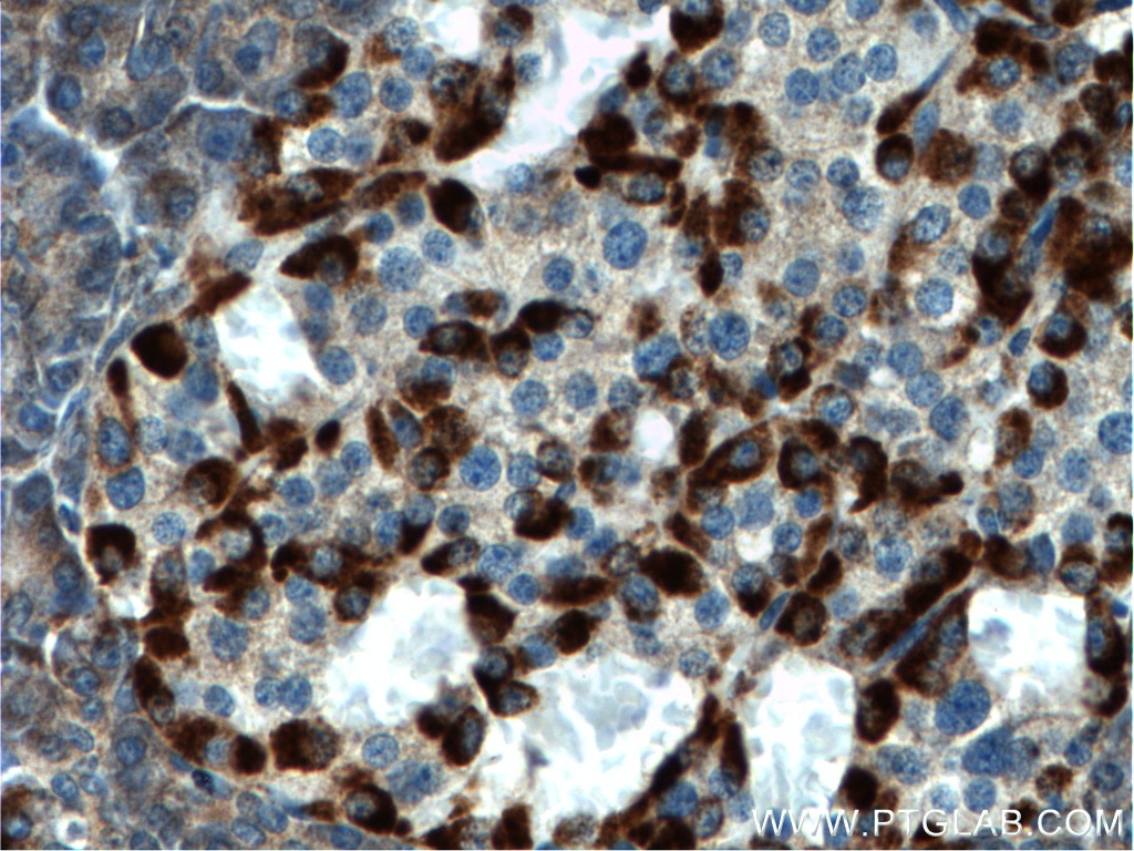IHC staining of human pancreas using 21432-1-AP