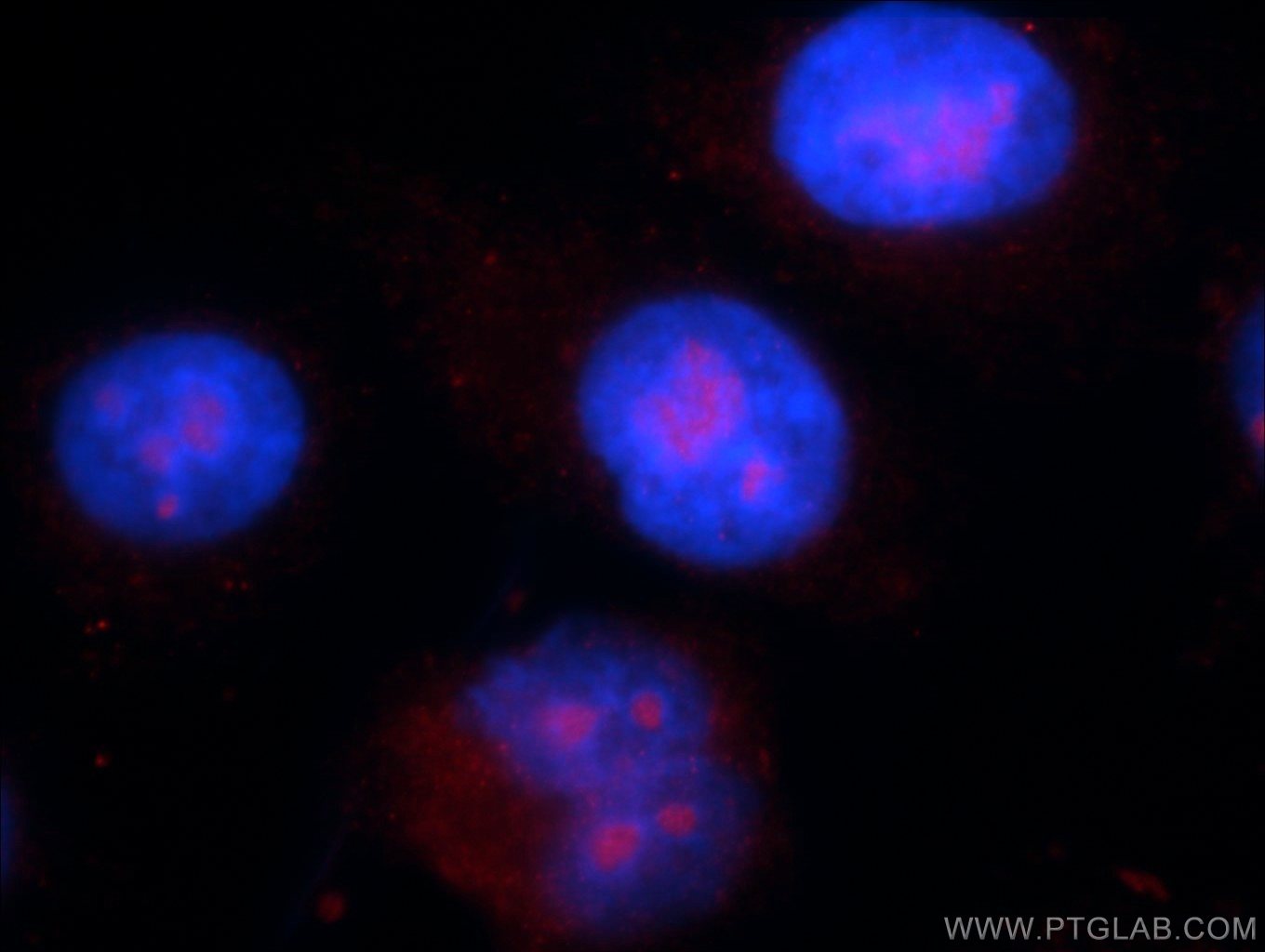 Immunofluorescence (IF) / fluorescent staining of HepG2 cells using Chk1 Polyclonal antibody (10362-1-AP)