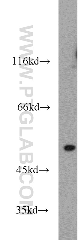 WB analysis of mouse thymus using 10362-1-AP