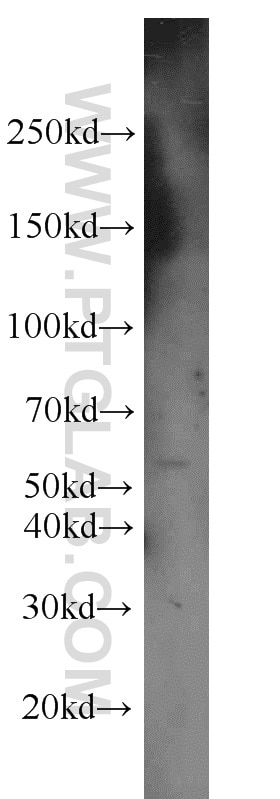 Western Blot (WB) analysis of HeLa cells using Chk1 Polyclonal antibody (10362-1-AP)